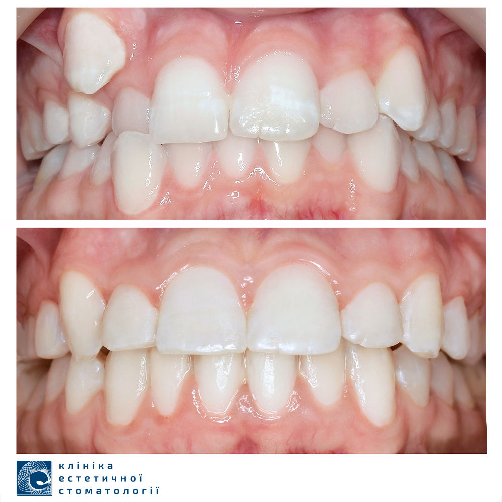 stomatologija-kieva-klinika-esteticheskoj-stomatologii-foto-10 stomatologija-kieva-klinika-esteticheskoj-stomatologii-foto-10