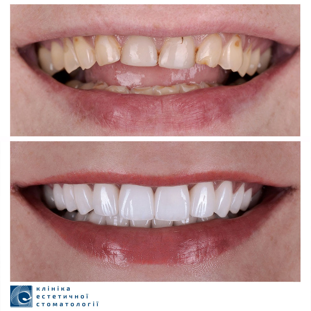 stomatologija-kieva-klinika-esteticheskoj-stomatologii-foto-8 stomatologija-kieva-klinika-esteticheskoj-stomatologii-foto-8